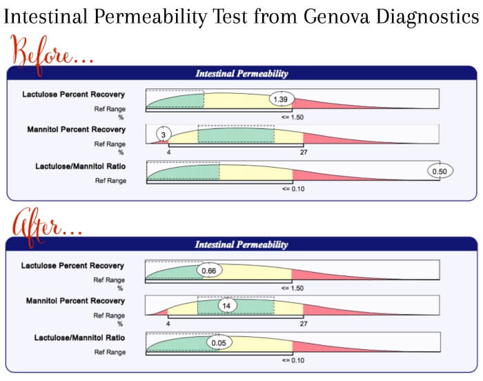 Intestinal Permeability