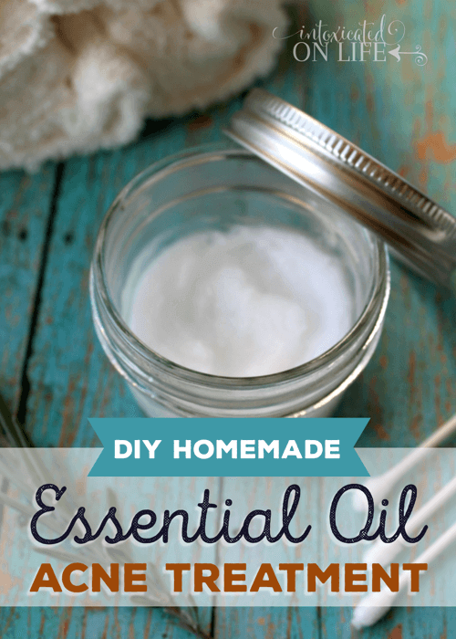 DIY Homemade Essential Oil Blemish Treatment