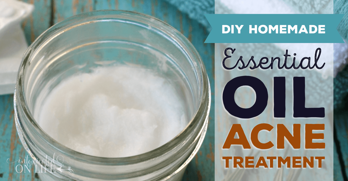 DIYHomemadeEssentialOilAcneTreatment-FB